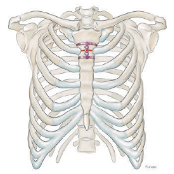 Sternal closure device